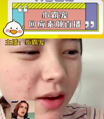 化妆品小霸宠首次透露素颜直播原因，审美跟大家不同，觉得满脸痘很好看