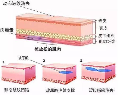 皱纹你和韩国欧尼之间可能只差了一个医美！