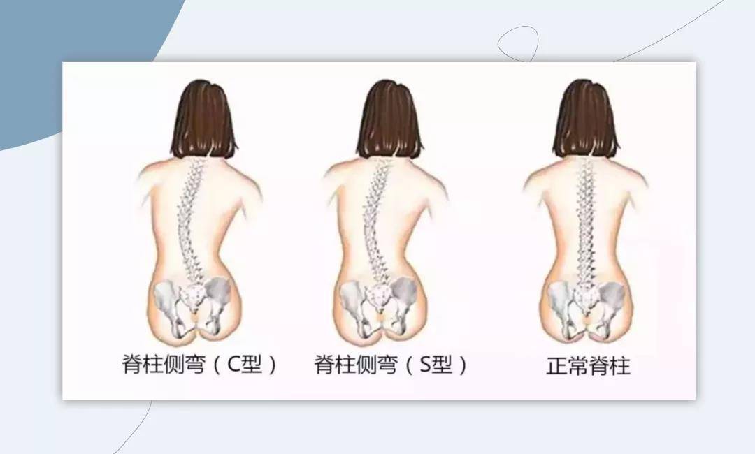 手机这些陋习，让你变丑的速度超过99%的同龄人！