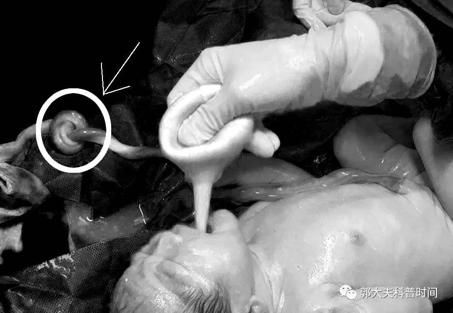 住院|妈妈安全，孩子优先，在产科，你永远不知道下一步会遇上什么坑！