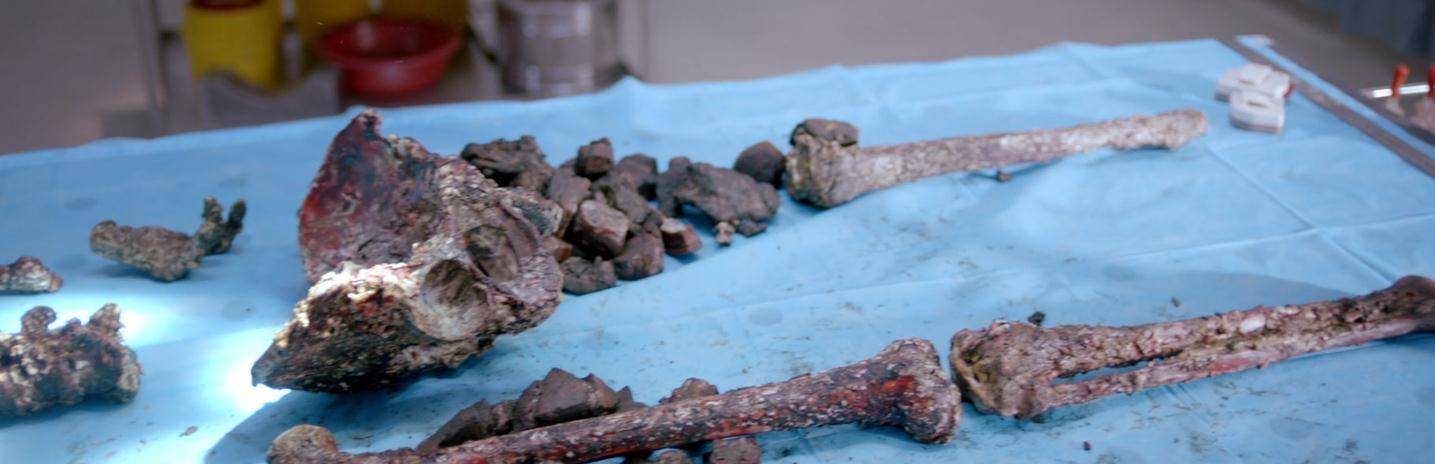 尸体|《法医秦明之无声之词》的三宗罪！求求编剧放过秦明