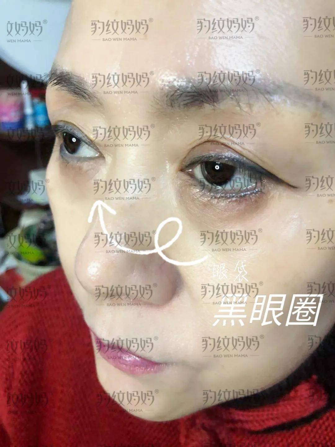 眼睛【真实分享】真人蜕变效果!让年龄成为秘密!