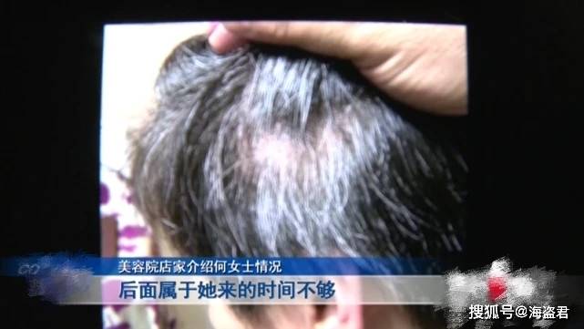 白转大妈美容院花4万“白发转黑”，头发变稀后哭诉：就是拔掉白头发