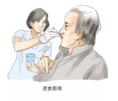 睡眠|瑞合康复 | 帕金森不止手抖这么简单！注意这些早期症状，早发现早治疗