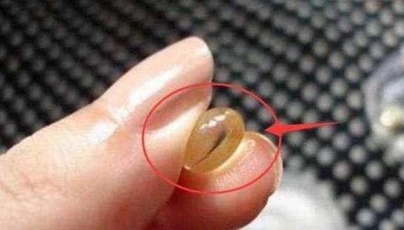 方法“维生素E”擦脸可以美白，很多人用错了方法，难怪皮肤没变化