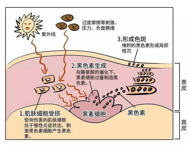 内调郑州美莱—科学祛斑的内调外养，具体要怎么操作呢？