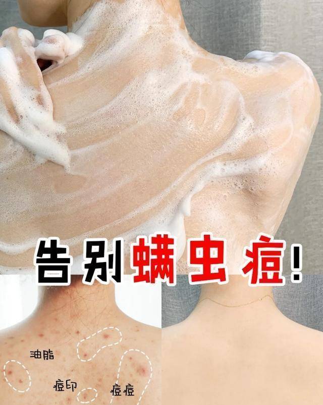 硫磺30岁沈梦辰当场卸妆出镜，素颜肌肤白皙细腻，宛如18岁少女