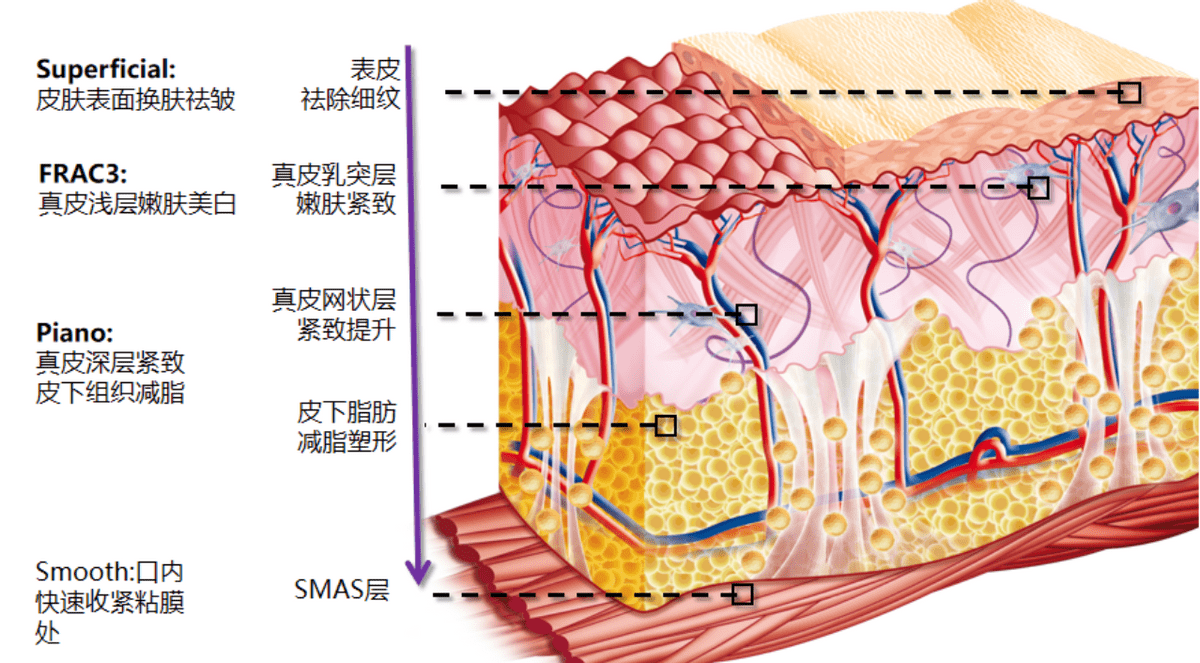 玛吉涨知识，欧洲之星的作用，欧洲之星和热玛吉哪个好？