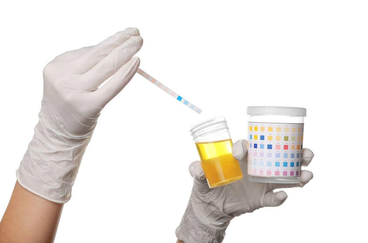 红细胞|尿隐血有了“加号”,要怎么办?要看血尿来自肾内还是肾外