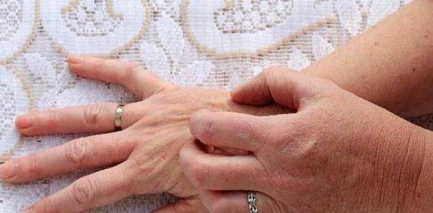 出现泡沫|肾衰竭的人，身体可能会发出3大“求救”信号，早了解早防范