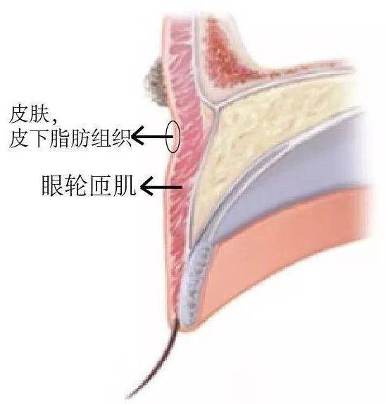 muller西安美莱—想避坑，先搞懂双眼皮的原理！