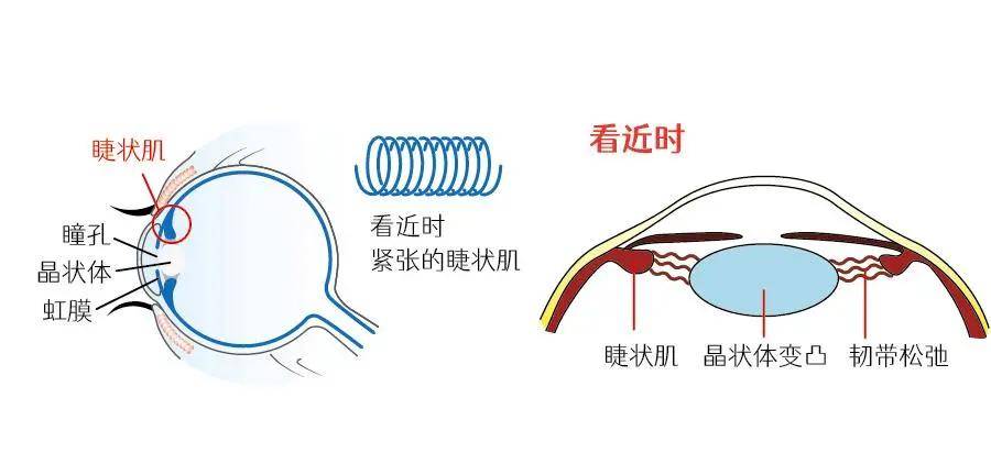 晶立方视力睫状肌是改善视力的重要关键原来物理训练才是提升视力的