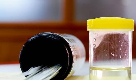 严重|注意：若出现这3个不对劲，可能是尿毒症“漏了破绽”