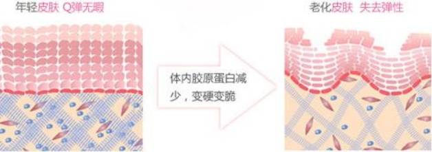 人体胶原蛋白肽是否有用？