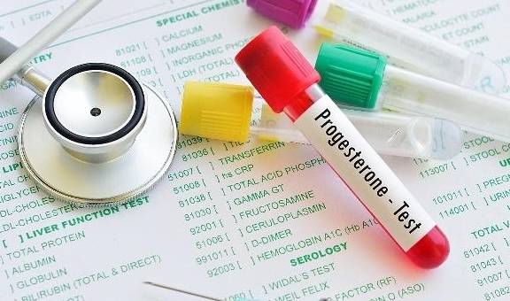 什么情况下要补黄体酮 2efe27ee62e249f28bd59263410eba9d.jpeg