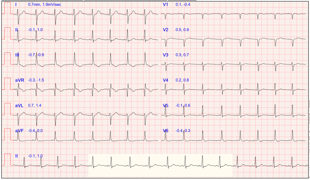 检查|装病？32岁女子一干活就晕倒！婆家人也不理解