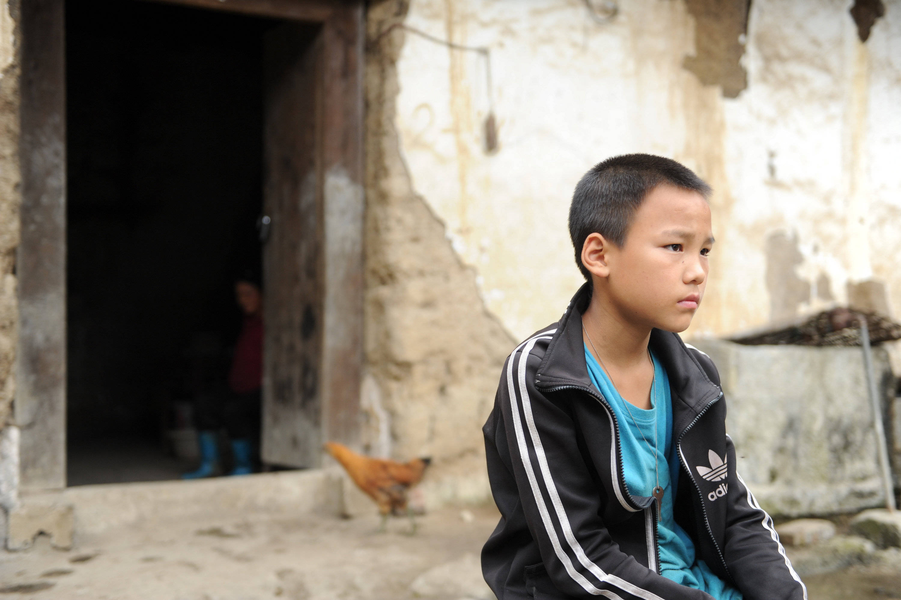 原创14岁男孩手指肿胀变形,只因长期喝奶茶饮料,折射出留守儿童之殇