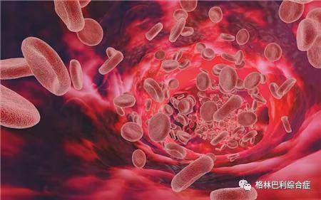 yfsszy|格林巴利综合症都有那些危害，并发症有那些？yfsszy