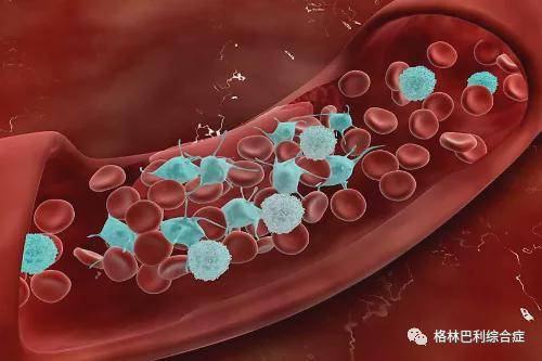 yfsszy|格林巴利综合症都有那些危害，并发症有那些？yfsszy