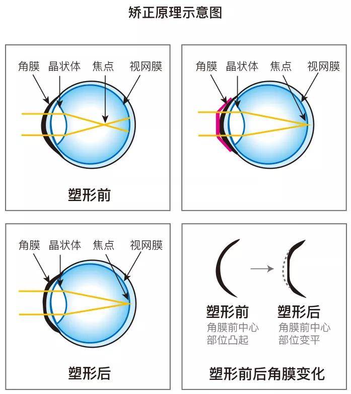 角膜高倍镜图片