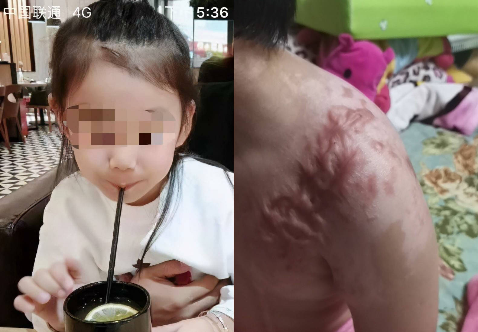 辽宁6岁女童被虐案主犯获刑16年，女童父亲：孩