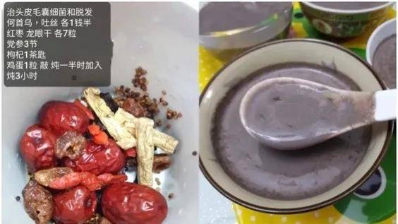 代谢|要是早知道这几招，最起码少掉几万根头发，心痛…