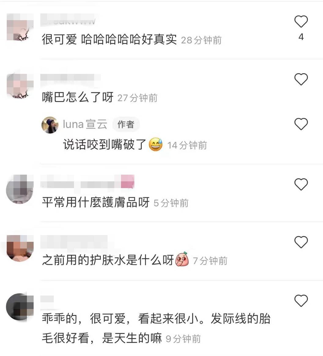 宣云潘玮柏太太宣云公开无滤镜素颜，皮肤白皙零瑕疵，嘴巴小伤口抢镜