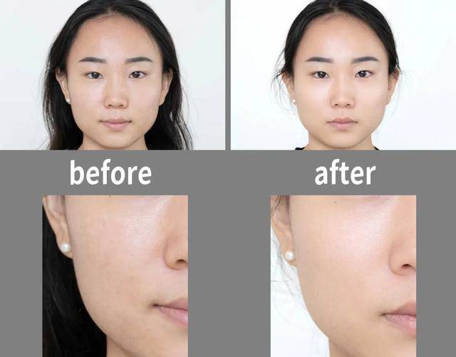 产品美肌‖他们要怎么做,才能让肤质显好不显老?