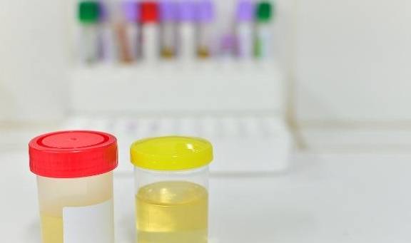 方法|“尿蛋白”无法转阴怎么办？2个“办法”许有助于延缓“肾衰”