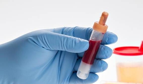 控制|糖尿病人尿液有泡沫?做2个检查3件事,心安一些