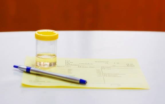 控制|糖尿病患者的尿又黄又骚是什么原因？你真的知道吗？看专家的理解