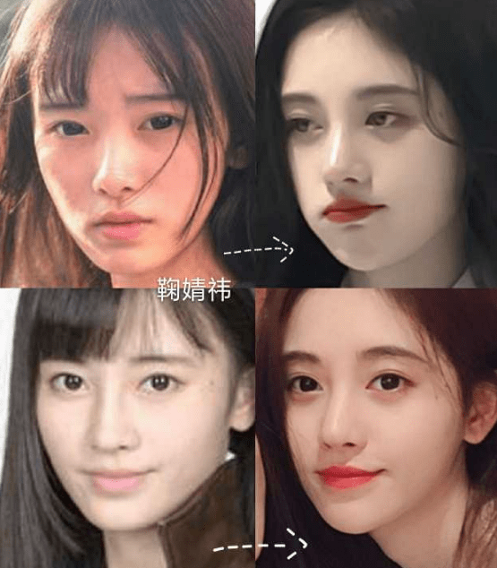 娄艺潇动脸的7位女星，一个比一个神奇，有人请医美专家鉴定自己纯天然