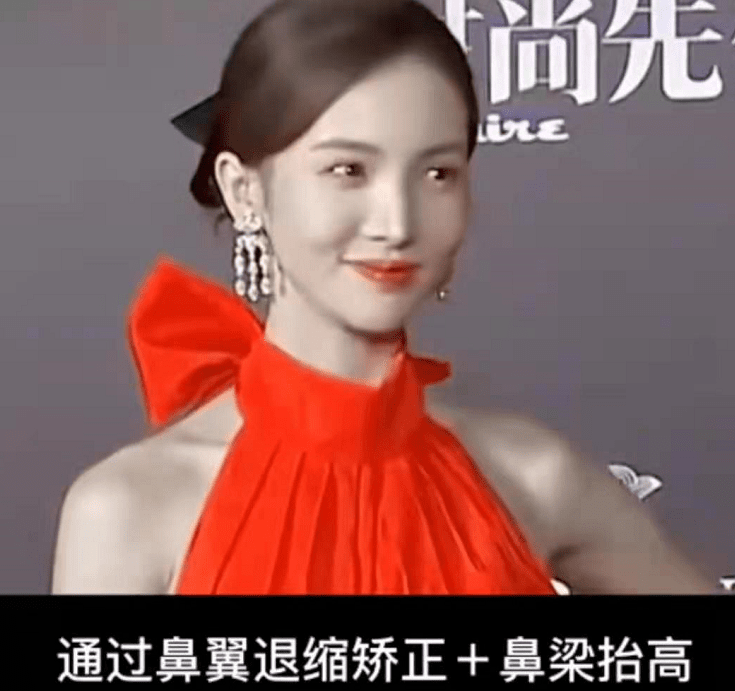 娄艺潇动脸的7位女星，一个比一个神奇，有人请医美专家鉴定自己纯天然
