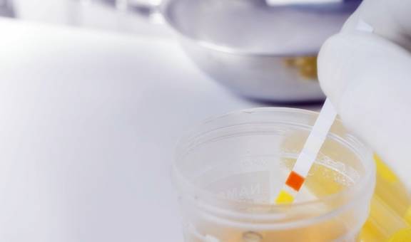 控制|糖尿病患者的尿又黄又骚是什么原因？你真的知道吗？看专家的理解