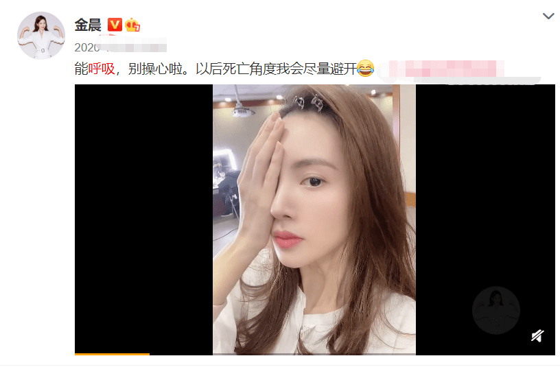娄艺潇动脸的7位女星，一个比一个神奇，有人请医美专家鉴定自己纯天然
