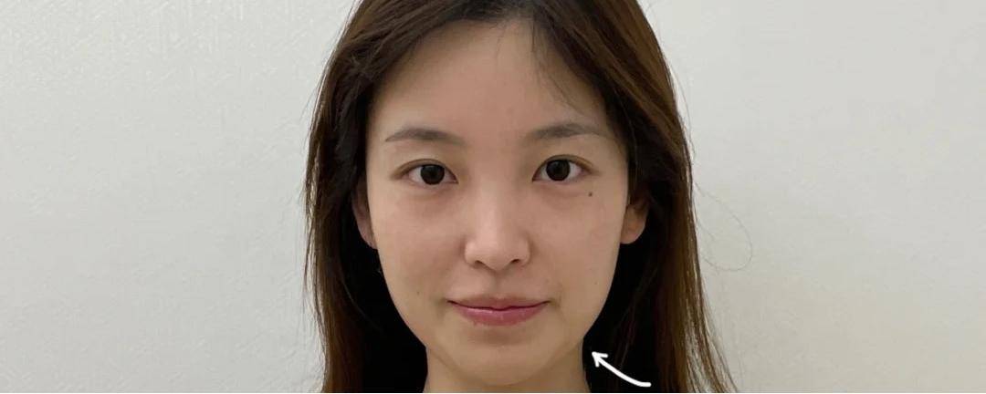 青春怎么消除法令纹？坚持六个小习惯，守住你的青春和美丽