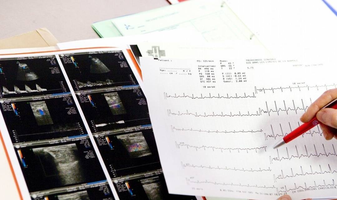 治疗|糖尿病人的终点是心血管疾病，降糖药选护心的很重要