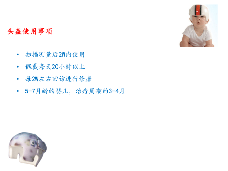 头颅畸形舟状头