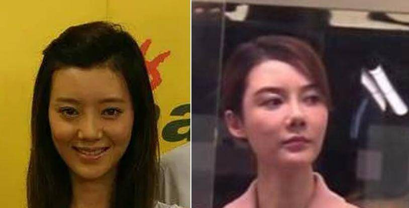 整形这是我见过最敢的女星，猪鼻子还能演美女？