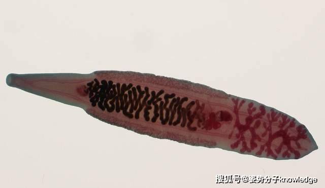 生肉|17岁女孩肠道内发现大量的虫子，寄生虫从何而来？该如何预防