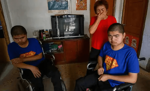 症状|运动神经元病早期与晚期治疗的区别