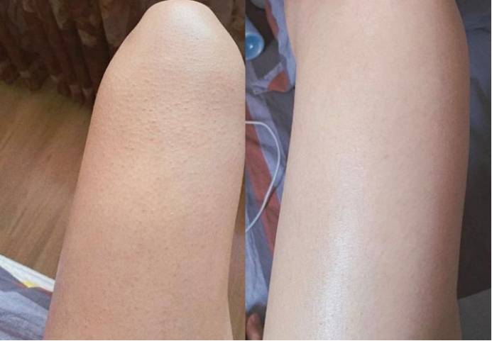 腿上一抹身体乳就疼痒怎么办(腿上一抹身体乳就疼痒怎么办呀)