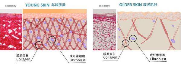脸部眼纹、眼袋、黑眼圈有救了！美容院开发的新项目？