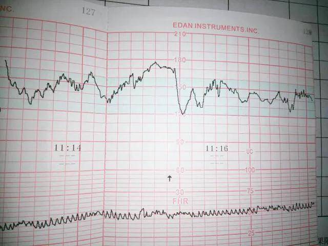 什么孕周做胎心监护