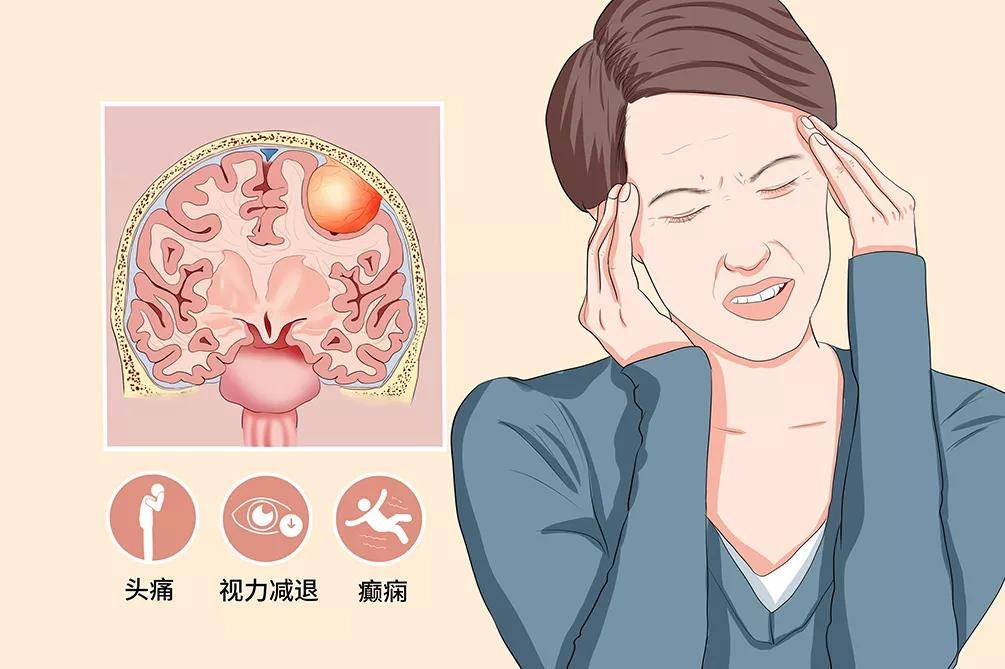 里长|脑袋里长这种瘤是不是100%没救了?看完这篇文章你就明白了！