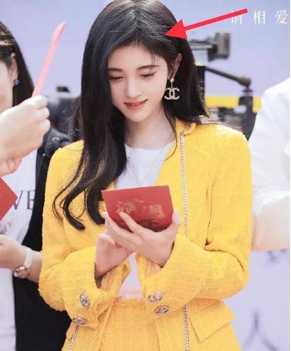 假发|她耳后斑秃？