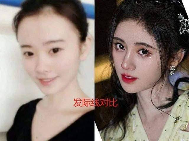 假发|她耳后斑秃？