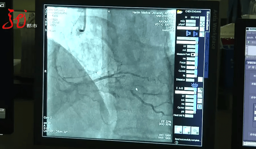 抢救|一女子突然倒地昏厥，“大白”跪地抢救……严寒心脏该如何保养？