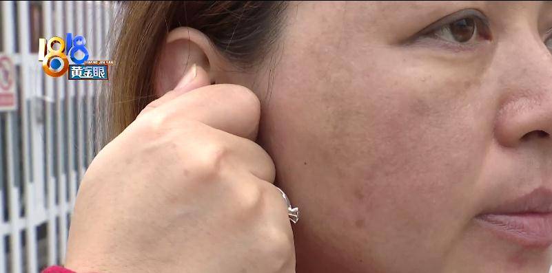 块状“拨筋”手法重,白净变黑斑?