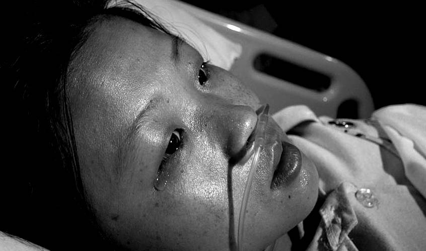 严重|易患尿毒症的女性，早期特征都很明显，但很少人会注意到